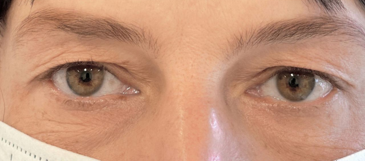 Po